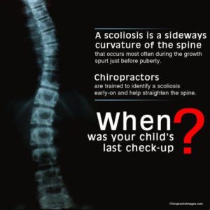 Scoliosis Chiropractor